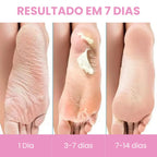 Máscara Peeling Esfoliante para os Pés - Soft Feet