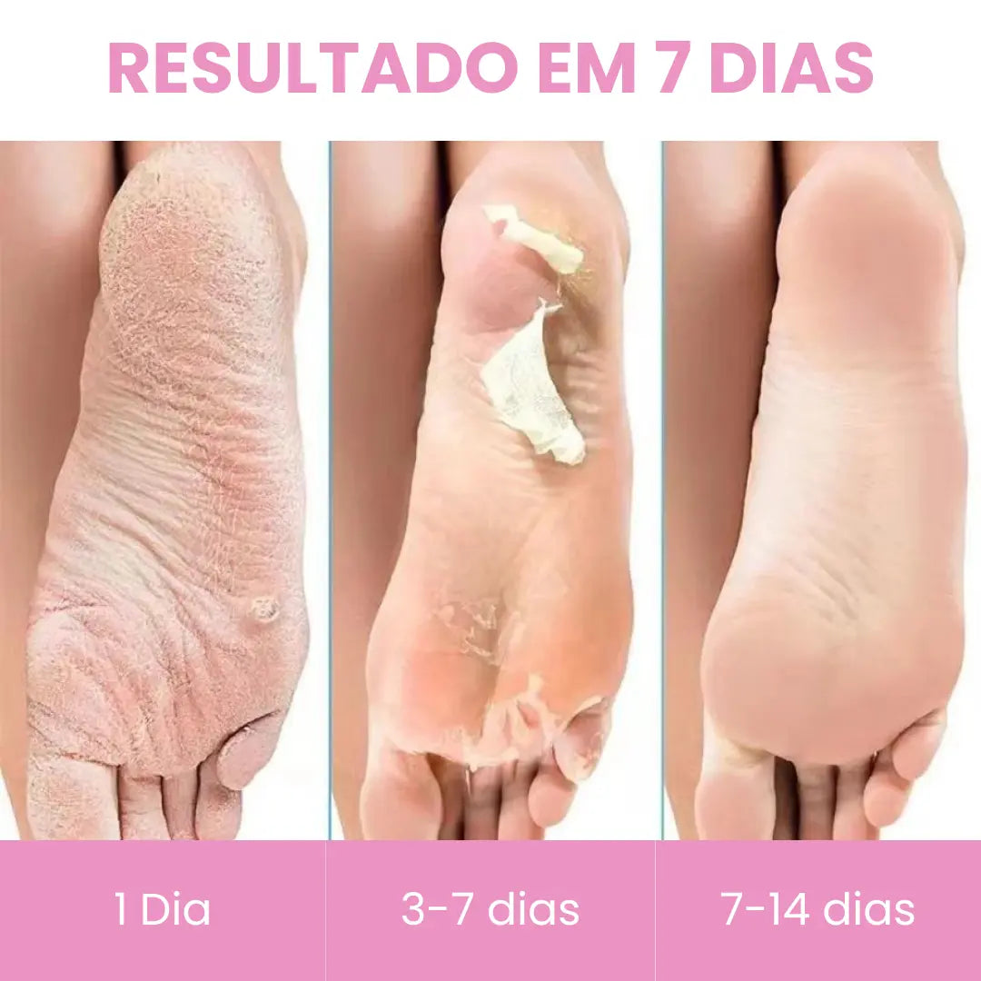 Máscara Peeling Esfoliante para os Pés - Soft Feet